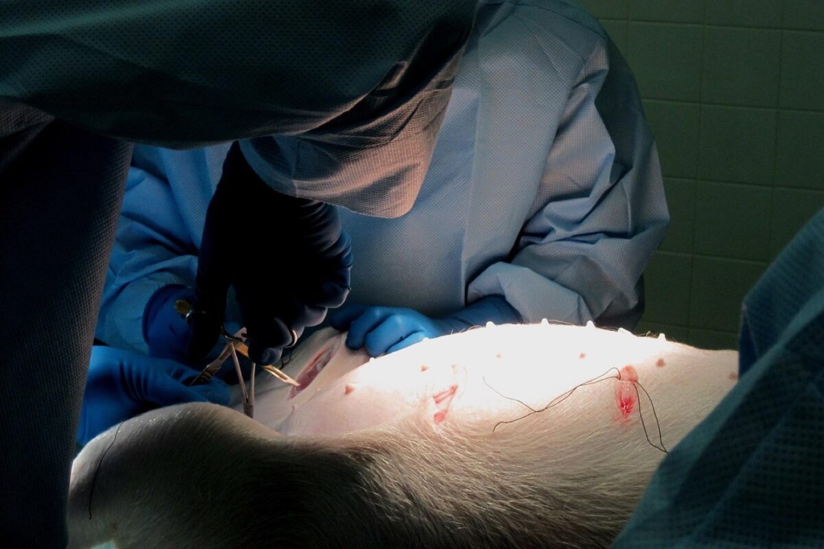 Choisir un antalgique après une chirurgie digestive